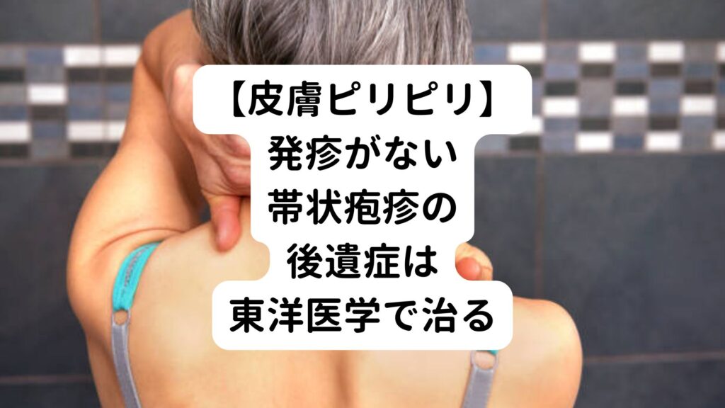 【皮膚ピリピリ】発疹がない帯状疱疹の後遺症は東洋医学で治る