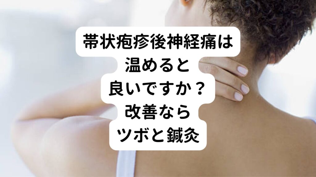 帯状疱疹後神経痛は温めると良いですか？|改善ならツボと鍼灸