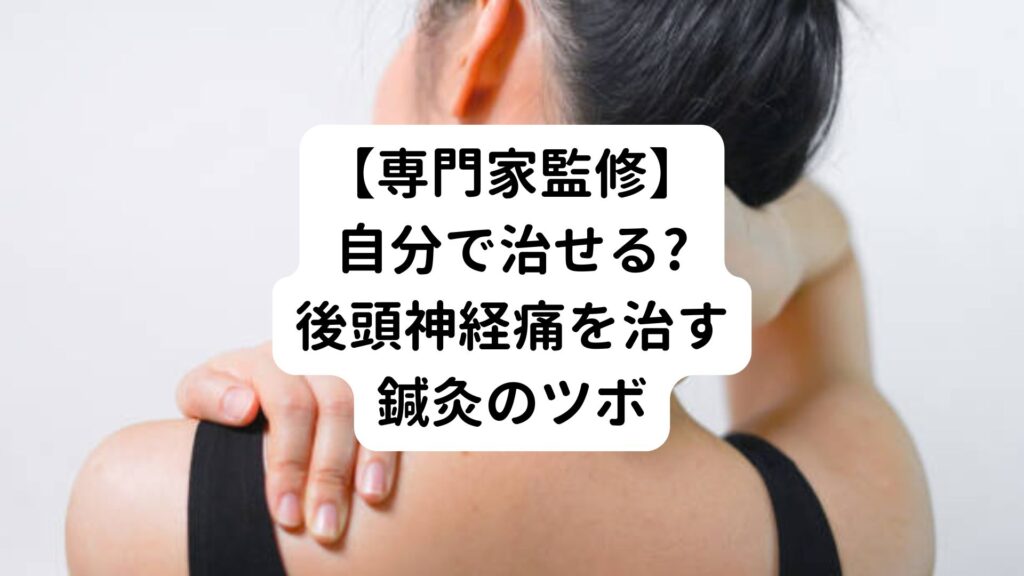 【専門家監修】自分で治せる?後頭神経痛を治す鍼灸のツボ