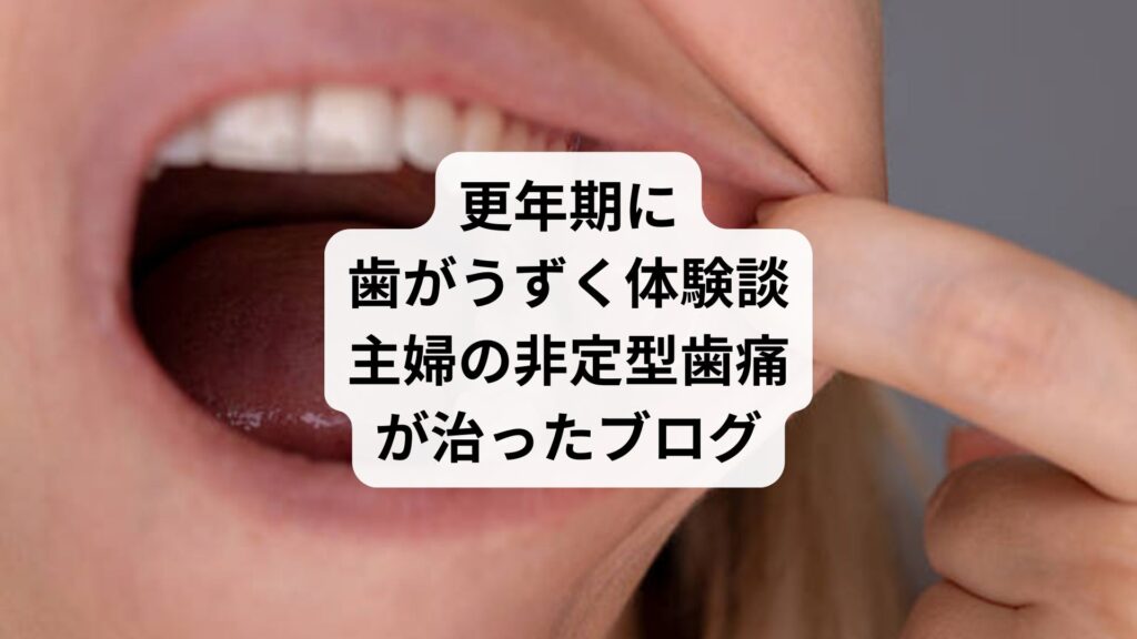 更年期に歯がうずく体験談｜主婦の非定型歯痛が治ったブログ