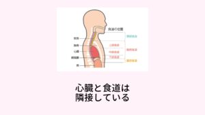 機械的に心房が刺激されることで不整脈が起こるこのような飲食など間接的な自律神経への刺激ではなく、じつは飲食物が食道を通過する際に直接心房や自律神経を刺激して不整脈を起こす不調もあります。

それを嚥下性不整脈と呼びます。
この嚥下性不整脈は2つのパターンで起こります。

一つ目のメカニズムは飲食物が食道を通過するときに食道の真裏にある心房を機械的に押してしまい心房が刺激されて不整脈が起こるものです。
解剖学的にみると食道と心臓は隣接しています。

そのため飲み込んだ飲食物が食道を通過する際に食道壁を隔てて心臓を押してしまう現象が起こります。
この現象によって心臓に直接刺激が加わり不整脈が起こるといわれています。イメージするなら心臓マッサージのような刺激が起きているといっていいでしょう。※2.