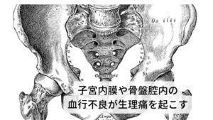 子宮内膜や骨盤腔内の血行不良が生理痛を起こす生理痛が起きる原因のひとつに子宮内膜や骨盤内に生じた血行不良があります。
この血流不良を東洋医学の考えでは瘀血（おけつ）と血虚（けっきょ）といいます。

瘀血（おけつ）は出血した血がスムーズに排出されずに滞ってしまい溜まっている状態。
血虚（けっきょ）は血を排出したことにより身体の血が足りなくなってしまった状態。

この二つの状態になると月経痛が生じるとされます。※2