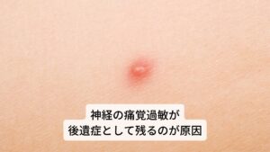 帯状疱疹後神経痛はウイルスによって傷つけられた神経が過剰に興奮してしまい、痛覚過敏やアロディニア(小さな刺激でも痛みとして感じてしまう脳の誤作動)などが起こるとみられています。

主な症状は「持続的でジリジリと焼けるような痛み」や「断続的なズキズキと刺すような痛み」が混ざって生じます。
その他にもさまざまな痛みを生じたり、逆に痛覚などの感覚が鈍くなることもあります。※2