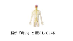 「頭がズキズキ痛い」は脳が「痛い」と認知している片頭痛の発生のメカニズムは炎症反応であると説明しましたが、じつは「片頭痛は炎症反応」＝「だからズキズキ頭が痛い」という関係ではありません。

正しい痛みの感じ方は「脳神経に炎症反応が起こる」
→「脳が炎症反応を認知」
→「炎症を認知し脳が痛みを感じるように反応する」
→「実際に頭がズキズキ痛いと感じる」
という流れになります。

これが「脳が痛いと感じる」というプロセスが必要です。