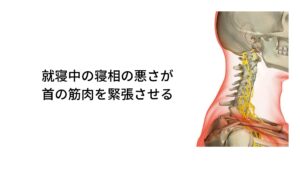 就寝中の寝相の悪さが自律神経を乱れさせるまた寝違えが起こる要因には就寝中の寝相の悪さや枕の不具合などで起こる自律神経の乱れがあります。
寝違え症状は厳密にいうとケガとはいえず、痛みや可動域制限(首が動かない)を引き起こしているのは「筋肉の過緊張」です。筋肉の強い緊張がおさまらずに継続していることが首の痛みを引き起こしています。

この筋肉の緊張が起こってしまう要因に寝相の悪さなどがあります。就寝中は誰でも力を抜いて「身体の筋肉が弛緩している」とイメージされていますが、実は微妙に力が入っています。
それが床面に接している体表です。とくに頸部に関しては枕の位置や高さによって頭部の重さを支えるために枕と接している首にストレスがかかり筋肉の緊張が起こります。

就寝中のこの首の過緊張が長時間起こると自律神経が乱れて寝違え症状である首の痛みや頭痛などを引き起こします。