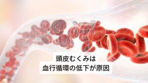 頭皮むくみは血行循環の低下が原因むくみが起こる主な原因は血行循環の低下によるものです。

血行循環が低下すると血管内の水分が滲み出ることで水分が貯留してしまいます。
この貯留した水分がむくみになります。

頭皮のむくみの場合は頭部の皮膚に張り巡らされた血管から水分が滲み出ることで頭皮がブヨブヨとむくみます。
そのため頭皮の血流を低下させている原因を完治することがむくみの改善のポイントになります。