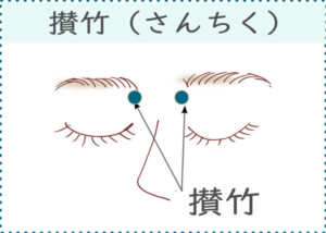 薬を飲んでも頭痛が治らないときに効くツボ【脳のオーバーヒートに効くツボ】
・攅竹（さんちく）・・・眉頭の少し下にある小さなくぼみに位置するツボ。

【ツボマッサージのポイント】
人差し指をやや立てた状態でツボの周囲を押してとズーンと響くポイントがあります。
響くところを見つけたらじっくりと5秒間指圧したあとに力を緩めずに小さく円を描くようにマッサージしてみてください。
これを左右の手で3セット行います。