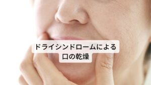 ドライシンドロームによる口の乾燥「口渇」とは唾液の分泌が減少することで、口の中が渇く症状を言います。乾燥することにより、舌や口の中に痛みが起こりやすくなったり、話しにくいさ、口の中がネバネバする、虫歯になりやすいなど、毎日の生活の中で口の中で不調を感じやすくなります。