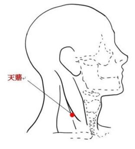 【治療例&効果の高いツボ 】ウイルス感染後に極端に疲れやすく寝込んでしまう（40代女性）【治療の体験者＆改善方法】
40代女性で「半年前にウイルス感染し、慢性上咽頭炎になってから疲れやすく寝込んでしまう」との訴えでご来院されました。
当院にご来院される前まで耳鼻科にて1週間に2回のペースでBスポット療法を受けていたそうです。

Bスポット療法の初期は上咽頭部の出血が綿棒で確認できていたようですが、現在は出血は止まっています。
そのため慢性上咽頭炎そのものの炎症は収まっており、現在は後遺症の自律神経失調症が残っていると判断しました。

当院では東洋医学的な問診と検査を行い、原因となる症状の体質をお調べしました。
状態は自律神経の乱れによる睡眠の質の低下による心身の慢性疲労と推測しました。

そのため治療方針を自律神経と心身の疲労回復に焦点を当てて鍼灸治療を行い改善を促しました。

【主に利用したツボ】
・天鼎(てんてい)・・・のど仏のすぐ下の軟骨(輪状軟骨)と同じ高さで、横首の筋肉(胸鎖乳突筋)の後側のへり。