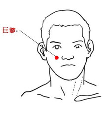 【改善例&効果の高いツボ 】下を向くと頭がズキズキする（30代男性）【治療の体験者＆改善例 】
30代男性で「体が疲れてきて下を向くとズキズキと頭痛がする」との訴えでご来院されました。

主訴では副鼻腔炎を疑いましたが、来院前に耳鼻科での検査では副鼻腔炎ではないとのこと、さらに当院での問診と検査で頭痛が起こるところを特定したところ「偏頭痛」と診断しました。
仕事による強いストレスや睡眠不足などが心身の疲労を溜めこみ偏頭痛が発症したのではないかと思います。

また副鼻腔炎ではないもののストレスによって鼻炎症状が起きるとのことなので、鍼灸治療では心身のストレス完治させて偏頭痛を改善させると同時に鼻炎の完治の治療も行い改善を促しました。


【主に利用したツボ】
今回の頭部や鼻部などの不調には巨髎というツボを利用します。リラックス効果も引き出せるため痛みの鎮静には効果的です。
・巨髎（こりょう）・・・瞳の中央から下ろした線と、小鼻の横を結んだ線の交わるところ。

※副鼻腔炎(蓄膿症)に対する効果的なツボを解説しています。
　詳細な情報は下記のリンクからご覧ください。