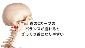 首のCカーブのバランスが崩れるとぎっくり首になりやすい本来首は緩やかなCカーブを描いて重たい頭をバランスよく支えています。

しかし、長時間パソコンやスマホなどを使用する際に姿勢が悪い状態でいると、このCカーブのバランスが崩れてしまい、重たい頭を支えるために首から背中の筋肉や関節にストレスがかかり疲労が蓄積されます。
この状態が毎日のように続いてしまうとこの蓄積疲労がきっかけとしてぎっくり首を起こすことになります。

ぎっくり首を起こす方の中には「夜寝る前までは首が痛くなかったのに朝起きたら首が激痛で起き上がれない」と訴えます方がいます。
これは日常生活における首の負担増大に就寝中における血流の問題も関係します。※1 