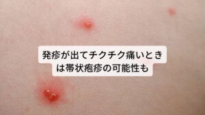 発疹が出てチクチク痛いときは帯状疱疹の可能性も後頭神経痛に似た症状に帯状疱疹があります。

帯状疱疹は慢性疲労など身体の免疫力、抵抗力が低下すると出現する水ぼうそうと同じウイルスによる病気です。
帯状疱疹もチクチクやピリピリといった神経痛を引き起こしますが後頭神経痛との違いは発疹や水ぶくれが起こることです。

帯状疱疹は早めの処置をしないと強い神経痛が後遺症として残ることがあります。
そのため頭部に痛みが出現した際は発疹や水ぶくれがないかを確認し、帯状疱疹であれば早めに専門医に受診する必要があります。

※3 帯状疱疹後に起こる神経痛は下記のブログから