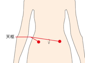 【治療例&効果の高いツボ 】緊張するとお腹がドクドクして気持ち悪い（30代女性）【治療の体験者＆改善方法 】
30代女性で「半年前から緊張するたびにお腹が脈うつようにドクドクして気持ち悪い」との訴えでご来院されました。

当院にご来院される前に内科で胃腸を検査しましたがとくに異常は診られず漢方薬のみを処方されました。
当院では東洋医学的な検査を行い身体の不調となる体質を調べて鍼灸治療を行うようにしました。

主な症状が緊張による腹部の異常な蠕動運動とのことですが、詳しくお話をお伺いするとやや腹痛や下痢も起こりやすく、入眠障害と食欲不振もあるとのことです。
ストレスによる神経疲労（自律神経の乱れ）によって不調を起こしていると推測し、ストレス完治と胃腸の消化機能を高める鍼灸治療を行うよう改善を促しました。

【主に利用したツボ】
天枢は胃腸の蠕動運動を整えるために用いるツボになります。
・天枢（てんすう）・・・臍の中心から外側に指幅3本分の場所。