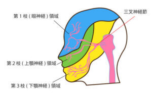 非定型顔面痛の特徴的な症状非定型顔面痛の特徴的な症状を解説します。

[非定型顔面痛の特徴的な症状]
・持続的な鈍い痛み
・圧迫されたような痛み
・しびれ感
・皮膚を触ったり圧迫しても痛みが起こらない
・皮膚表面ではなく深い部分の痛み
・三叉神経の分布に沿って痛みがない
・顔面の片側に痛みが起きている（まれに両側に起こる）
・目の周囲、前頭部、頬部、鼻部、上顎部、下顎部などにみられる

三叉神経痛との見分け方には「三叉神経の分布に痛みがない」「電撃痛（鋭い痛み）ない」「三叉神経の分布を触っても痛みが起きない」というものがあります。
これがない場合は非定型顔面痛の可能性があります。※2