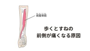 歩くとすねの前側が痛くなる原因歩くとすねの前側が痛くなるのはすねの前側にある筋肉が硬くなって骨を引っ張ることで起こります。

すねの周りにはさまざまな筋肉が付着していますが、主に痛みを起こす筋肉は前脛骨筋、趾伸筋、腓骨筋など足首や足の指を動かすものがあります。


これらの筋肉は歩いたり、走ったり、ジャンプしたりするときによく使う筋肉です。
動作をするたびに筋肉は緊張し硬くなりますが、特に負担がかかるのがすねの骨を覆っている前脛骨筋になります。

この引っ張る状態が長く続くと前脛骨筋の筋膜にストレスがかかり続け炎症がおきて痛みが起こります。