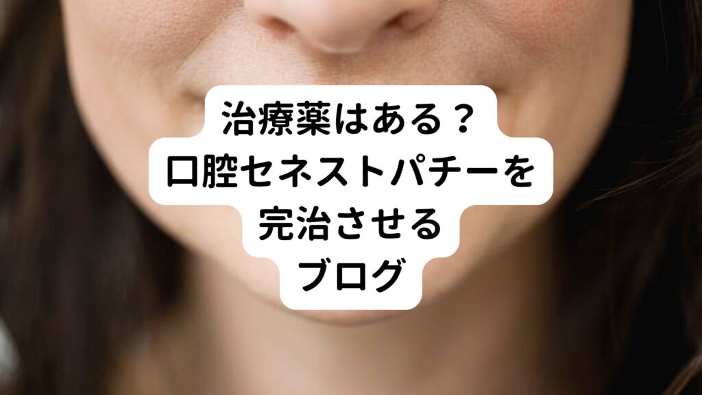 【治療薬はある？】口腔セネストパチーを完治させるブログ