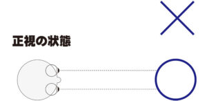 片側の目の視線が逸れてしまうと斜視が起こる斜視とは片眼は目標のほうに正しく向いているが、もう一方の眼が内側や外側、上下などに視線が逸れている状態の事を指します。

斜視は眼のトラブルの中では外見的特徴として比較的わかりやすい状態です。
タレントさんでも時折いらっしゃいますので、どのような状態かはイメージしやすいかと思います。

この斜視の種類は斜視のある側の目がそれぞれ、

・内側に向くものを内斜視
・外側を向くものを外斜視
・上や下を向くものを上下斜視

などといい、その他に恒常的な斜視であるか、時々起こる間欠性の斜視か、先天的または後天的な斜視か、などの条件で病名は細かく分類されています。

斜視がある方の目の状態をご説明します。(今回は左目が外斜視の人の場合)

目の前の〇に焦点を合わせようとします。
右目は真っ直ぐ捉えていますが、左目は○に合わせることができずに×を捉えてしまっています。

このような状態では脳に「右目の〇と左目の×」の映像が送られてしまいます。

映像が重なってしまうと非常に生活しにくくなるため、脳は斜視である左目からの映像を「抑制」という脳機能を使って見ないことにしようと調節します。
これによって映像が重なることのない映像として脳が処理して物を見ることができるわけですが、両眼視機能は失われ立体視ができない片眼視の状態になってしまうのです。

これにより片眼は抑制による映像の遮断が続いてしまうため、視力が低下する傾向があり、弱視となる可能性もあります。
これが俗に言うガチャ目と呼ばれるものです。