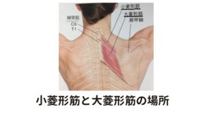 小菱形筋と大菱形筋も頑固なこりがある上図のように、小菱形筋と大菱形筋は背骨の棘突起というところから肩甲骨の内縁に走行しています。
肩甲挙筋と同様にこの筋肉の場合も骨に付着する場所にとても重要な治療ポイントがあります。

他の筋肉よりも見逃されがちですが筋肉というのは、どの筋肉でも付着部に負担がとても大きくなるためこの筋肉でも頑固なこりが形成しやすい傾向にあります。
そのためしっかり意識して鍼灸治療することが肩こり完治につながります。

そしてもっと重要な肩こりの真犯人がこの菱形筋の更に深い場所に隠れています。
それが上後鋸筋です。