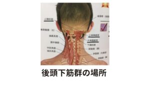 三つの筋肉が合わさって後頭下筋群を構成しているこの三つの筋肉(上頭筋・小後頭直筋・大後頭直筋)をあわせて後頭下筋群(こうとうかきんぐん)と呼ぶこともあります。

この後頭下筋群は眼精疲労や目の疲れにとても関係の深い筋肉です。
その理由には目の焦点を合わせるときに働く毛様体筋(もうようたいきん)が働くときに、この後頭下筋群も連動して収縮していることがあげられます。

この首の付け根の左側にこりがあれば左目に反応があり、右側にこりがあれば右目に反応があると考えられています。
この反応はおおよそ7割くらいの確率で起こっています（当院調べ）。

ここに頑固なこりがあると、他にも頭痛、目の奥の痛み、後頭神経痛などを引き起こすこともあるため注意が必要です。
これらの筋肉は体表からは深い場所に位置するため、鍼治療が適しています。

これら後頭下筋群すべてのこりに鍼灸治療をすると治療後は視界が明るくなって頭もスッキリ軽くなります。

次は前斜角筋と中斜角筋です。
この筋肉は特に女性が特にこりやすいです。

この頚椎から肋骨にかけて走行する筋肉で肋骨を引き上げて呼吸を補助する働きがあります。
女性は構造上、男性と違い胸式呼吸が多いためこの筋肉が疲労しこりやすい傾向にあります。