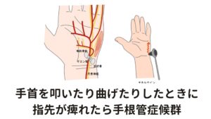 手首を叩いたり、曲げたりしたときに指先が痺れたら手根管症候群横手根靭帯の下を通るのは正中神経だけでなく、９本もの筋肉の腱が同時に走行します。
ストレスにより手先の筋肉が緊張したり、手のむくみがあると気候変動による手根管症候群が発症しやすい傾向にあります。

特徴的なしびれ方には、

・手首を叩いた時に指に痺れが出る
・手首を深く曲げ保持をするとしびれが強くなる

というものがあります。