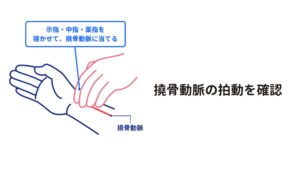 脈の早さを調べてツボを上手に使い分けるまず、手首に触れる撓骨動脈の拍動を確認します。

脈が速い方(1分間に80拍以上)は、「照海」を使います。
脈が遅い方(1分間に60拍以下)は、「照海」と「腎兪」を使います。