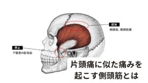 片頭痛に似た痛みを起こす側頭筋とは側頭筋はこめかみと耳の上を結ぶ線から後頭部の方向へ長方形につらなる頭皮下の筋肉です。
顎の動きに関わる下顎骨（顎の関節あたり）にくっついているため噛むときによく使われる筋肉になります。