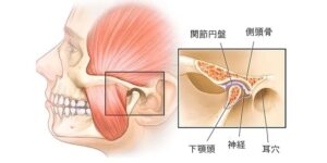 [顎周囲の筋肉を緩める]
顎関節周囲の筋肉の緊張は俗にいう「食いしばり」を引き起こしている原因と考えられます。
食いしばりはストレスに対する無意識の反応です。
そのため食いしばりで酷使される筋肉を緩めることによって間接的に脳へのストレス、自律神経の乱れを減少させることができます。