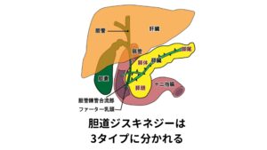 胆道ジスキネジーは3タイプに分かれる胆道ジスキネジーの症状は食後に発生することが多く、胆のうの収縮の仕方によって、緊張亢進型、運動亢進型、緊張低下型の3つに分類されます。
このタイプによって症状の出方が異なります。
※胆道ジスキネジーは、胆のう収縮ホルモンの刺激に対してファーター乳頭の開閉に異常が生じ、胆汁の排出がうまくいかなくなることが一つの要因として考えられています。

【(1)緊張亢進型】
食後数時間後から腹痛が生じます。
胆のうの緊張により収縮が遅れるため胆汁がうまく出せない状態です。
それにより胆のうの圧が高まり、パンパンに張って痛みが起こってしまいます。
【(2)運動亢進型】
食事直後に腹痛が生じます。
食事をすることで刺激され、急激に胆汁が排出されるときに痛みが起こります。
【(3)緊張低下型】
腹部に持続性の重い痛みが生じます。
胆のうの収縮が弱く、胆汁の排出が遅れることで痛みが起こります。