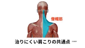 治りにくい肩こりの共通点またトリガーポイントという特殊な筋肉のこりであるかを調べました。
頭の付け根にある後頚筋群と呼ばれるトリガーポイントに触診を行ったところ頭痛の再現がありました。

この反応からトリガーポイントに伴う頭痛であることが断定できました。

治りにくい肩こりには共通点があります。

・上部僧帽筋の緊張度が高まっている
・肩甲骨の自由な動きが阻害されている

この2つの反応がある場合は肩こりが治りにくくなり、尚且つトリガーポイントによる頭痛が起こりやすいとされています。