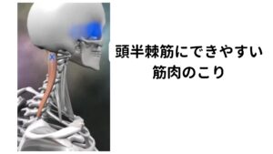 頭半棘筋にできやすい筋肉のこりさきほど解説した板状筋同様に頭半棘筋も頸椎の伸展、回旋動作、側屈動作にも関与します。


頭半棘筋他の首の筋肉に比べると太く、筋力は強い性質があります。
板状筋の次に頚部の伸展に関わります。