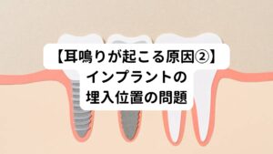 インプラントは顎骨にインプラント体を埋入する外科手術を伴う治療です。

その埋入する際に位置がずれたり治療器具が当たったりなどすることがあります。
この物理的な刺激が周囲の神経や血管を傷つけることにつながり神経の過敏性を高めて耳鳴りが引き起こすことがあります。

この場合は治療した部分からの出血、腫れ、痛みなどの症状も出ることがあるので、耳鳴り以外の症状も調べてみてください。
また、上顎の場合は深くインプラント体を埋め込んでしまうと、上顎洞に穴が開いてしまうこともあります。
それにより細菌感染が起こり、蓄膿症や副鼻腔炎のような症状が起こるケースがあります。
これらの症状も耳鳴りを引き起こす可能性を高めます。