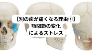 歯の治療によって、顎関節の動きが変化することがあります。
この変化によって、噛んだ時に他の歯に負担がかかることで痛みを引き起こすことがあります。

顎関節の位置や動きが正常な状態に戻るまで他の歯に痛みが続くことがあります。
また顎に付着する噛む筋肉へのストレスが増大することも歯痛につながることがあります。


どちらも物理的なストレスの増加によって引き起こされる歯の痛みになります。