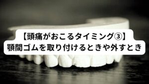 歯並びの種類によっては、治療中に上顎と下顎を繋げる顎間ゴムを使用します。
取り付けるときや外すときに頭痛を感じることがあります。