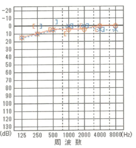 【再発から3回目の問診】
耳鼻科での聴力検査では正常値の20dB以下の範囲内まで回復する。
念のため残り2回程度鍼灸治療をしたがとくに異常がないため鍼灸治療を終了する。
