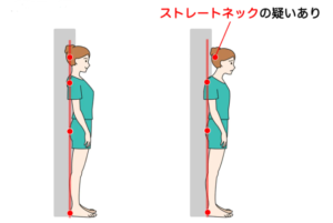 まず、首の状態をセルフチェックで確認しましょう。
次の手順で簡単に調べられます。

①壁に背中を向けて、まっすぐに立つ
②ゆっくり後ろに下がり、かかと、お尻、肩甲骨の順に壁に背中をつけてアゴを引いて後頭部を壁につける

自然に立ったときに何も問題なくスムーズに後頭部が壁につく場合は、ストレートネックではないと判断します。
しかし、顎を引いて後頭部を付けたときに喉の違和感が起きたてきはストレートネックの可能性の可能性があります。

このセルフチェックで姿勢を崩さずに後頭部が壁につかない場合、ストレートネックが進行しているといえます。
また意識すれば後頭部が壁につく程度であれば、軽度のストレートネックです。