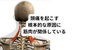 薬をやめないといけないと分かっていても「なかなかやめられない」と不安や焦りがある方もおられるのではないでしょうか。
当院でも頭痛の辛さと薬をやめたくてもやめられないという状態の板挟みでパニックになる方もおられます。


しかし、こういった頭痛症状は筋肉にできる痛みを引き起こすこり(トリガーポイント)を解消させれば治ります。

頭痛の出現するパターンや原因の筋肉は様々ですが、頭痛に関係する主な筋肉は肩甲挙筋です。
この肩こりの代表筋である肩甲挙筋は、重い頭を支えている筋肉なので、頭痛を引き起こすトリガーポイント(筋肉のこり)ができやすいです。
このトリガーポイントが慢性化すると頭痛やめまいなどが出やすくなります。