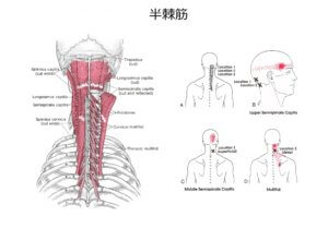 半棘筋は後頭部から背骨にかけてつく筋肉です。
主に下を向いた際に頭を支えることが役割です。
そのため現代社会ではデスクワークにおけるパソコンやスマホの作業で下を向くことが多いため負担のかかる筋肉です。
半棘筋の筋肉が硬くなる箇所によってはこめかみや首の付け根にも痛みを起こすことがあります。