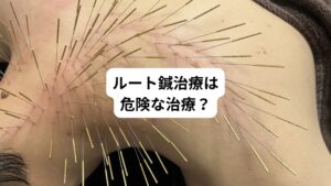 「ルート鍼治療って鍼を身体に沢山刺すんですよね?怖いんですけど。」
「知り合いでルート鍼治療を受けた後、しびれが出たり、逆に気持ち悪くなったりしたって聞きました。」
「以前、ルート鍼治療を一度受けたことがあったのですが、その時痛みが悪化して二度と受けたくないと思いました。」
ルート鍼治療を受けたあとにこのような嫌な体験を受けた方はおられるのではないでしょうか。
鍼灸について何も知らない状態で実際にルート鍼治療受けたことで良い印象が無く不安だけが残ると「鍼灸は嫌い!」となってしまいます。
上記の回答は実際にご来院された患者様で多くの方にご質問いただいたルート鍼治療の感想の一部です。
皆さまの中でも初めてみる鍼灸治療がルート鍼治療だとあまり良いイメージはなく「鍼灸は危なそうで怖い」と敬遠してしまう人も多いと思いのではないでしょうか。
こういった「鍼灸治療に対する危険視」のご質問は鍼灸師という仕事をしていて本当に多く聞きます。
そこで今回は「ルート治療は危険|ルート鍼治療は止めるべき理由と安全性について」と題してルート鍼治療の危険性と正しい鍼灸治療の安全性について詳しく解説します。