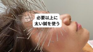 鍼灸では太い鍼を使用すればそれだけ体を傷つけることになるので体にとって負担が増大します。
またその太い鍼で沢山刺すのであれば上記で解説した「鍼あたり」が起こる可能性も高まります。
またルート鍼治療の場合、太い鍼を使用して「まぶた」を集中して刺すことがあります。
この治療は大変危険です。
実際にこの治療を受けた方で「眼球に鍼が刺さって視力が低下した」という方も出ております。