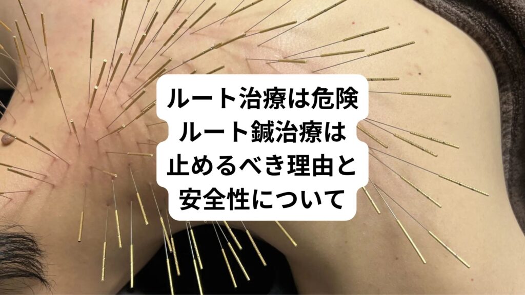 ルート治療は危険｜ルート鍼治療は止めるべき理由と安全性について