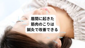 つまりは眉間に起きた筋肉のこりが解消できれば「いやな痛みの持続、頭に放散するジンジンとした頭痛」は改善することができます。
当院ではこの眉間に起きた筋肉のこりを解消させる鍼灸治療を行っております。
三叉神経と自律神経が複合した頭痛(TACs)でお悩みの方はぜひ当院の鍼灸治療を受けてみてはいかがでしょうか。