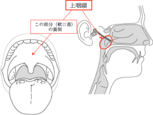 上咽頭は軟口蓋の裏側にある部位です。
耳管(鼻と耳をつなぐ管)に近い場所にあります。
子供の頃にアデノイドがあった場所です。
風邪などにかかると鼻の奥が痛くなることがありますが、この症状はこの上咽頭に炎症が起きている状態です。