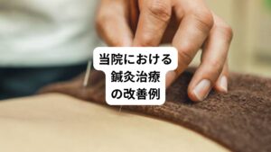 当院では非定型歯痛についての病態、鍼灸治療の効果方法、大まかな治療期間や通院頻度などについて説明を行いました。
同意を得たため、鍼灸治療を開始しました。
当初の症状の程度は比較的重度ではありましたが、治療開始1か月で当初の約60%まで痛みが軽減しました。
開始2か月で日中のジリジリした鈍痛は消失し、熱い物を摂取した際に起こる痛みが残存したが頻度は減少しました。
開始5か月目に一時的に痛みが再燃したときがありましたが、程無く痛みは落ち着きました。
その後も改善傾向は続き、治療開始から7か月で当初の症状の10%まで改善しました。
当院で推奨している漢方薬の服用も忘れるほどの改善であるため、薬の断薬を担当医に相談するよう指導し断薬も開始しました。
その後の断薬途中で、体調不良(風邪)や親族の不幸など心身の疲労が影響して非定型歯痛が再燃することが数度ありました。
その間は鍼灸治療の頻度を高めることで落ち着き、それ以降も概ね症状の経過は順調であった。
経過良好のため治療開始後10か月で治療終了となりました。