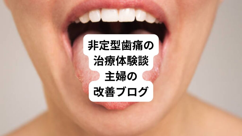 非定型歯痛の治療体験談|主婦の改善ブログ
