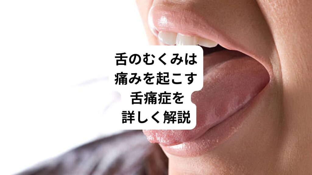 舌のむくみは痛みを起こす｜ 舌痛症を詳しく解説