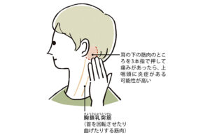 また自分自身では耳の下にある「胸鎖乳突筋(きょうさにゅうとつきん)」という筋肉を3本指で押すことで調べることができます。
押して痛みを感じた場合、上咽頭に炎症が起きている可能性が高いと考えます。
「慢性上咽頭炎かもしれない」と感じたら、ぜひ当院にご相談ください。