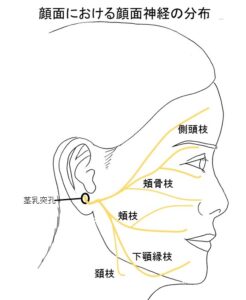 顔面神経麻痺とは、「顔の動きに関係する神経の一部が麻痺し、顔が動かなくなる状態」をさします。
脳から直接出てくる神経(脳神経)が12対あります。
顔に関わる顔面神経はこのうち7番目の神経です。

この顔面神経は、頭蓋骨から出ると枝分かれします。
このとき障害が起こった部分が脳に近ければすべての枝が麻痺し、枝の先であれば部分的に麻痺（末梢性）が起こります。