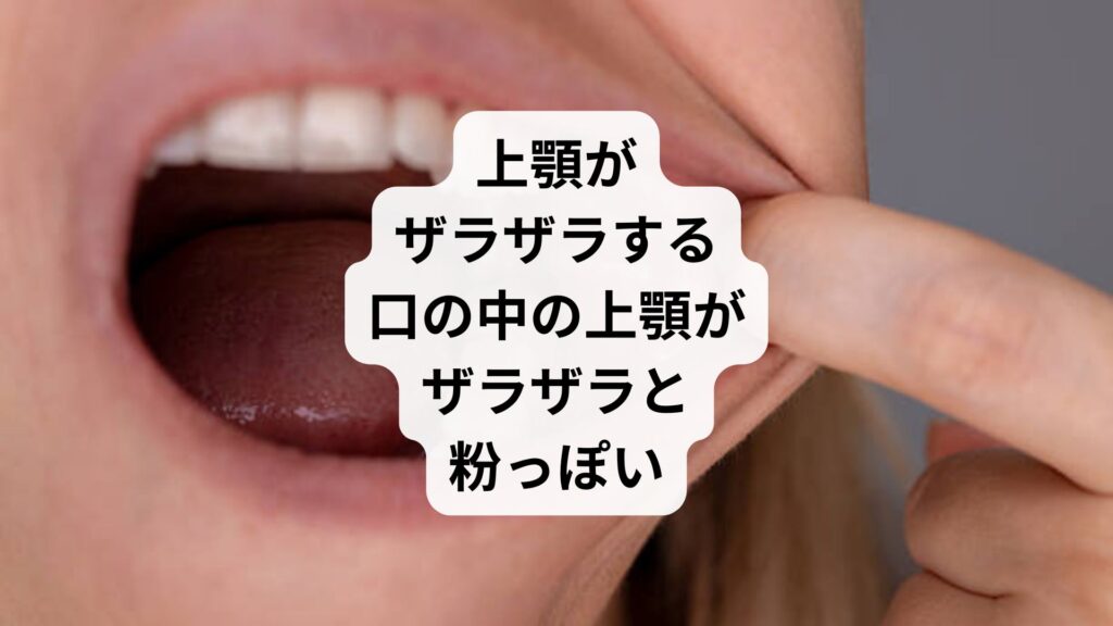 上顎がザラザラする|口の中の上顎がザラザラと粉っぽい