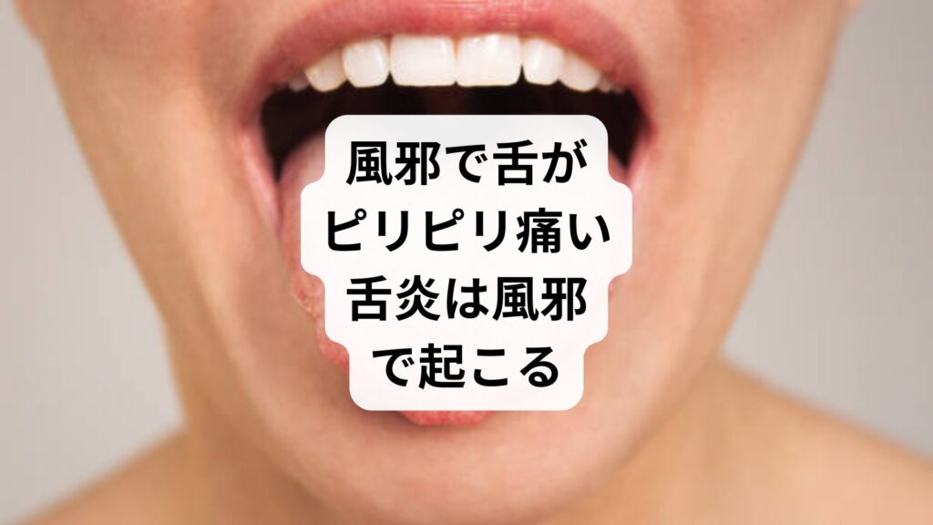 風邪で舌がピリピリ痛い|舌炎は風邪で起こる