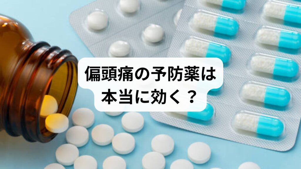偏頭痛の予防薬は本当に効く？ためしてガッテンで話題の対策と鍼灸による根本改善【5回の施術で改善した体験談付き】